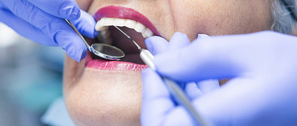 Best Emergency Dentist for Lost Fillings or Crowns in Atlanta, TX